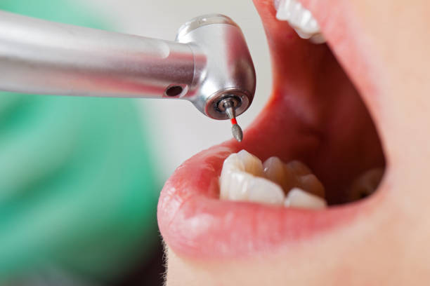 Best Emergency Dental Care for Sports Injuries in Elfers, FL